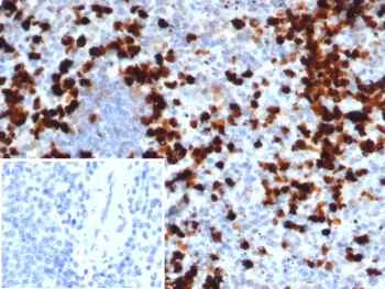 S100A9 Antibody / MRP14 / Calgranulin B / Calprotectin L1H - image 1