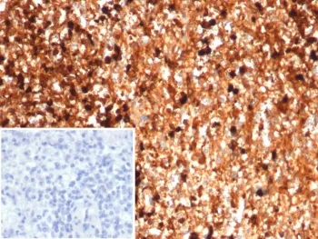 S100A9 Antibody / MRP14 / Calgranulin B / Calprotectin L1H - image 1