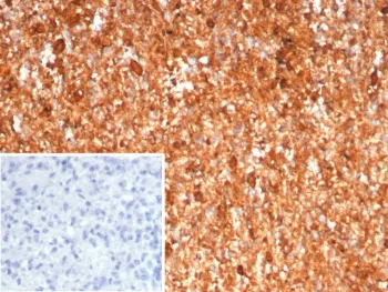 S100A9 Antibody / MRP14 / Calgranulin B / Calprotectin L1H - image 1