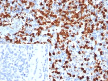 S100A9 Antibody / MRP14 / Calgranulin B / Calprotectin L1H - image 1