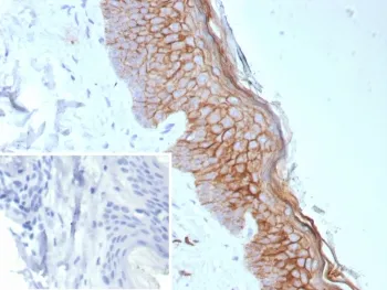 S100A14 Recombinant Antibody - image 1