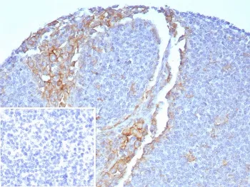 FCGR1A Antibody / CD64 - image 1