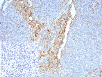 FCGR1A Antibody / CD64 - image 1