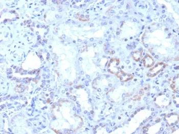 RORC Recombinant Antibody / ROR gamma - image 1