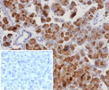 RORC Recombinant Antibody / ROR gamma - image 1