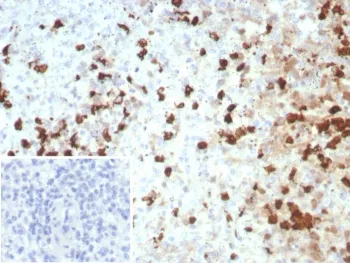 S100A12 Recombinant Antibody / CGRP - image 1
