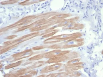 ACTN2 Recombinant Antibody / Alpha Actinin 2 / Sarcomeric Alpha Actinin - image 1