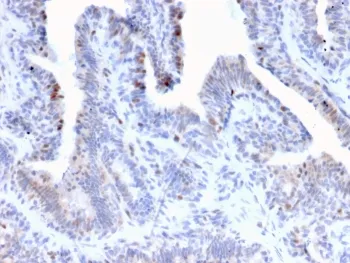 LRH1 Antibody / NR5A2 - image 1