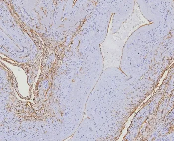 CD34 Recombinant Antibody - image 1