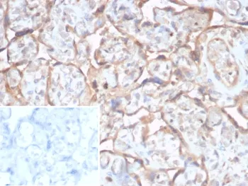 TGFB2 Antibody / TGF beta 2 - image 1