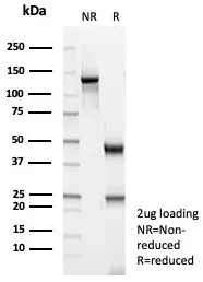 Actin Recombinant Antibody / Muscle Specific - image 1
