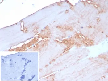 ACTN2 Recombinant Antibody / Alpha Actinin 2 / Sarcomeric Alpha Actinin - image 1