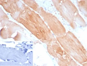 ACTN2 Recombinant Antibody / Alpha Actinin 2 / Sarcomeric Alpha Actinin - image 1