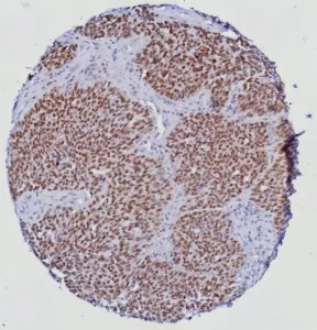 ERG Antibody / Transcriptional regulator ERG - image 1