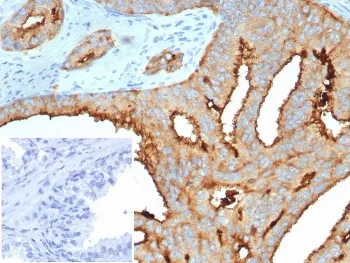 TMPRSS2 Antibody - image 1