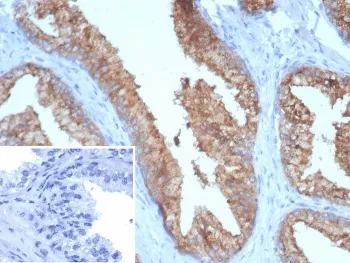 TMPRSS2 Antibody - image 1