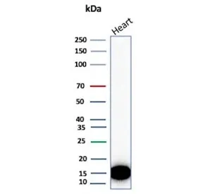 FABP3 Recombinant Antibody - image 1