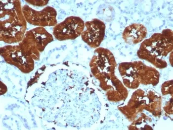 FABP1 Recombinant Antibody - image 1
