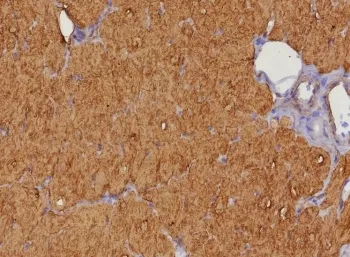 FABP3 Recombinant Antibody - image 1