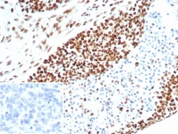 MSH6 Recombinant Antibody - image 1