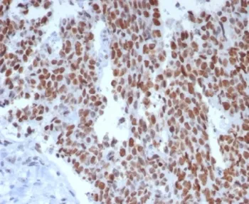 MSH6 Recombinant Antibody - image 1