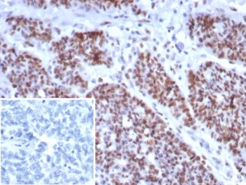 MSH6 Recombinant Antibody - image 1