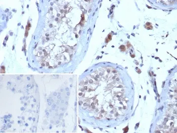 hCG Receptor / LH Receptor Antibody - image 1