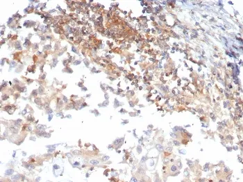 hCG Receptor / LH Receptor Antibody - image 1