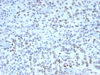MSH2 Antibody - image 1