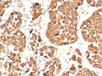ACTH Recombinant Antibody / Synacthen - image 1