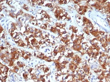 IL18R1 Antibody / Interleukin 18 receptor alpha - image 1