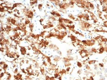 IL18R1 Antibody / Interleukin 18 receptor alpha - image 1