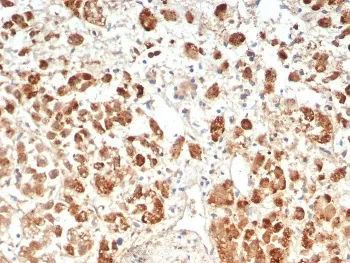 IL18R1 Antibody / Interleukin 18 receptor alpha - image 1