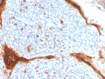 IL1RA Antibody / Interleukin-1 Receptor Antagonist / IL1RN - image 1