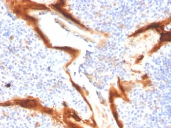 IL1RA Antibody / Interleukin-1 Receptor Antagonist / IL1RN - image 1