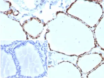 PAX8 Recombinant Antibody - image 1