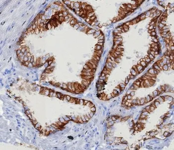 EpCAM Recombinant Antibody - image 1