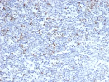 CTLA-4 Recombinant Antibody / CD152 - image 1