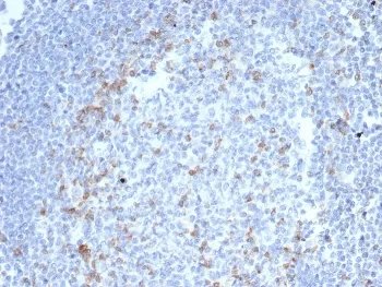 CTLA-4 Recombinant Antibody / CD152 - image 1