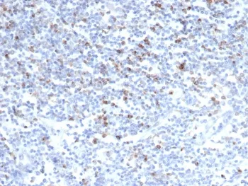 CTLA-4 Recombinant Antibody / CD152 - image 1