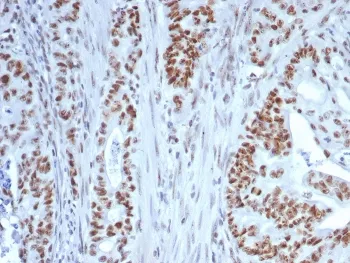 Nucleolin Antibody - image 1