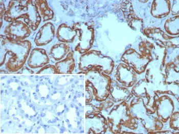 HSP60 Recombinant Antibody - image 1