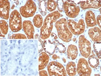 HSP60 Recombinant Antibody - image 1