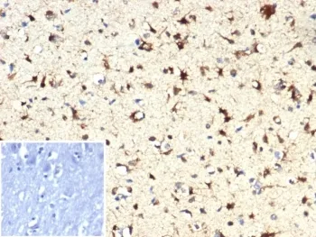 IDH1 Recombinant Antibody / Isocitrate Dehydrogenase (R132H mutant) - image 1