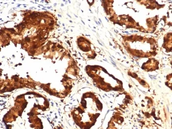 IDH1 Recombinant Antibody / Isocitrate Dehydrogenase (R132H mutant) - image 1