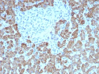 CPS1 Antibody / Carbamoyl phosphate synthetase 1 - image 1