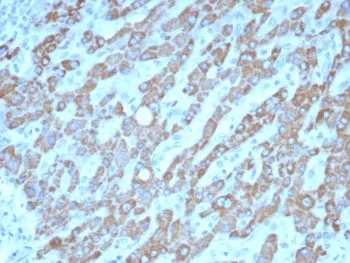 CPS1 Antibody / Carbamoyl phosphate synthetase 1 - image 1