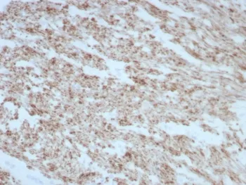 Desmin Recombinant Antibody - image 1
