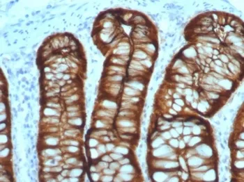 Villin Recombinant Antibody - image 1