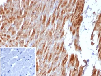 Desmin Recombinant Antibody - image 1